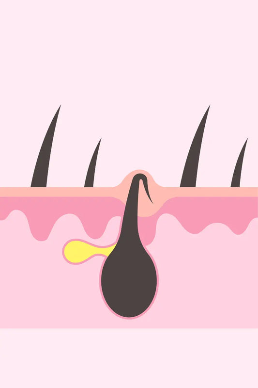 Say-Goodbye-to-Vaginal-Ingrown-Hairs-Naturally Naturally Created 4 You
