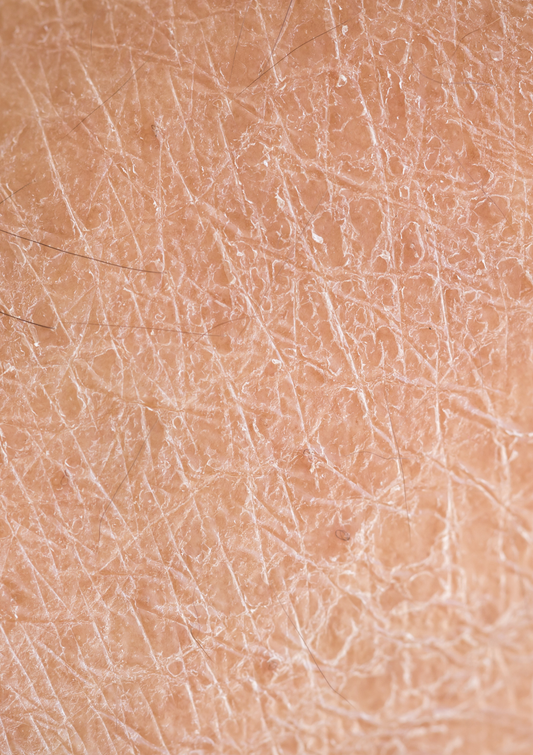 3 Powerhouse Natural Ingredients for Dry Aging Skin