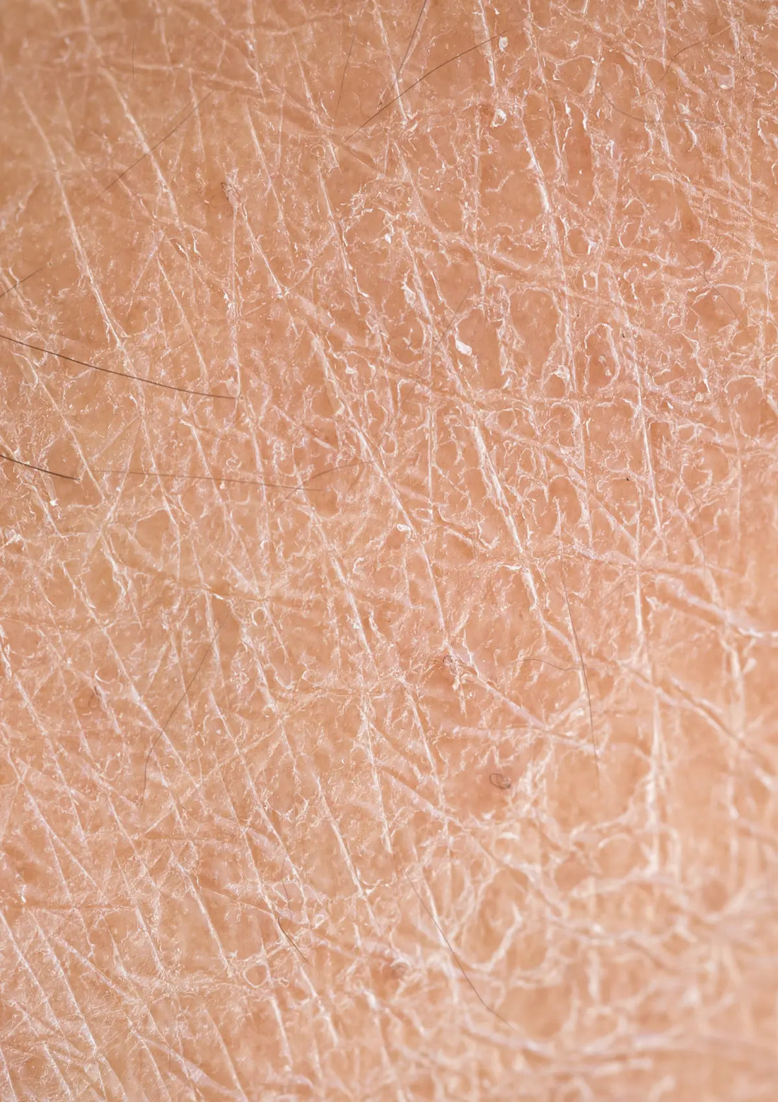 3 Powerhouse Natural Ingredients for Dry Aging Skin