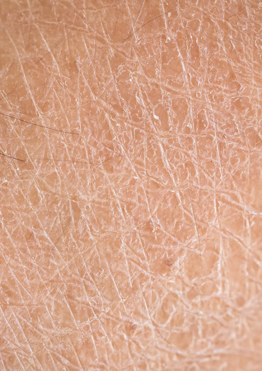 3 Powerhouse Natural Ingredients for Dry Aging Skin