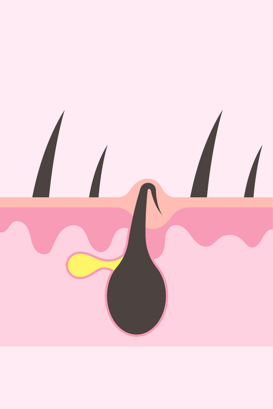 Say Goodbye to Vaginal Ingrown Hairs Naturally